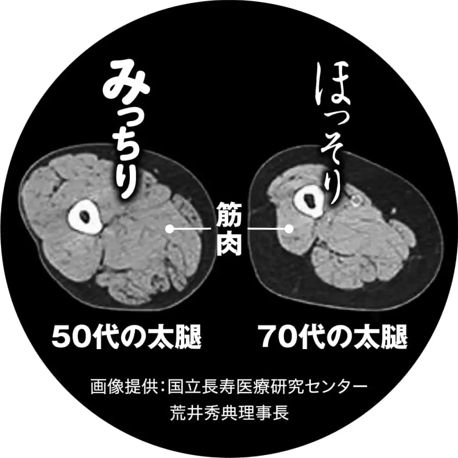 50代の太腿と70代の太腿