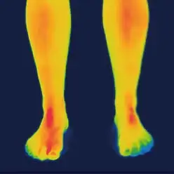 フジヒートの腹巻着用30分後のサーモ画像