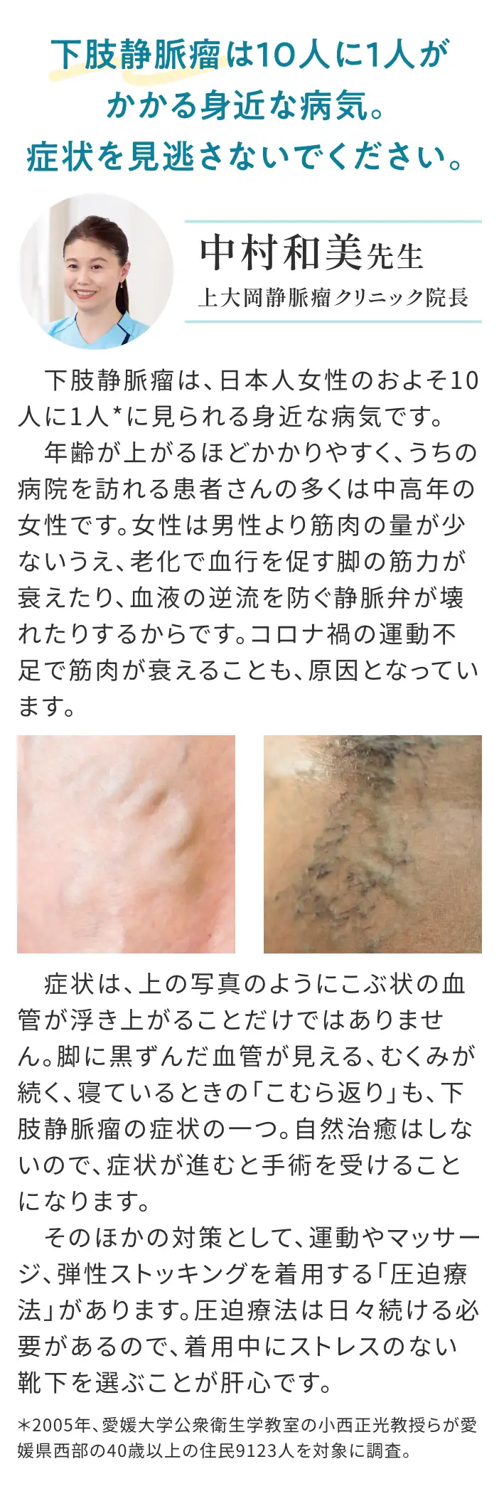 下肢静脈瘤は10人に1人がかかる身近な病気。症状を見逃さないでください。中村和美先生(上大岡静脈瘤クリニック院長)下肢静脈瘤は、日本人女性のおよそ10人に1人*に見られる身近な病気です。年齢が上がるほどかかりやすく、うちの病院を訪れる患者さんの多くは中高年の女性です。女性は男性より筋肉の量が少ないうえ、老化で血行を促す脚の筋力が衰えたり、血液の逆流を防ぐ静脈弁が壊れたりするからです。コロナ禍の運動不足で筋肉が衰えることも、原因となっています。 症状は、上の写真のようにこぶ状の血管が浮き上がることだけではありません。脚に黒ずんだ血管が見える、むくみが続く、寝ているときの「こむら返り」も、下肢静脈瘤の症状の一つ。自然治癒はしないので、症状が進むと手術を受けることになります。 そのほかの対策として、運動やマッサージ、弾性ストッキングを着用する「圧迫療法」があります。圧迫療法は日々続ける必要があるので、着用中にストレスのない靴下を選ぶことが肝心です。 *2005年、愛媛大学公衆衛生学教室の小西正光教授らが愛媛県西部の40歳以上の住民9123人を対象に調査。