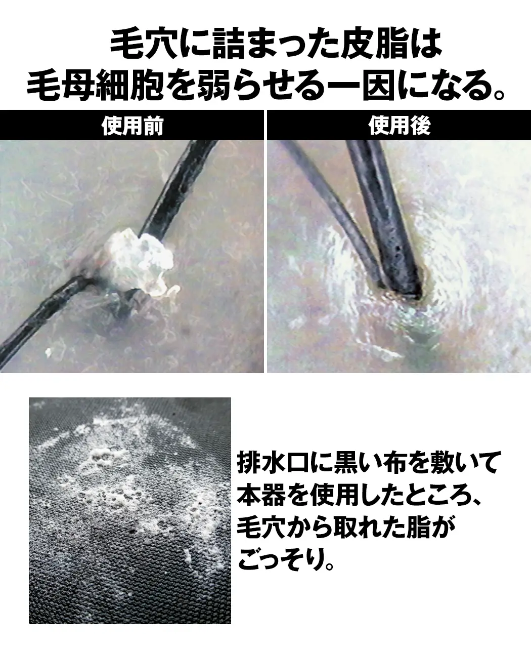 8時だよ 通販生活 頭皮洗浄器 ケアナケア 公式 カタログハウスの通販サイト
