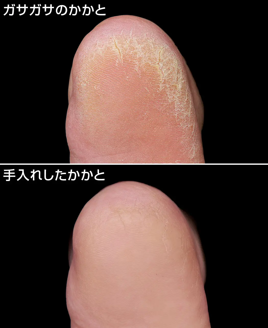 8時だよ 通販生活 かかとゴマージュセット 公式 カタログハウスの通販サイト