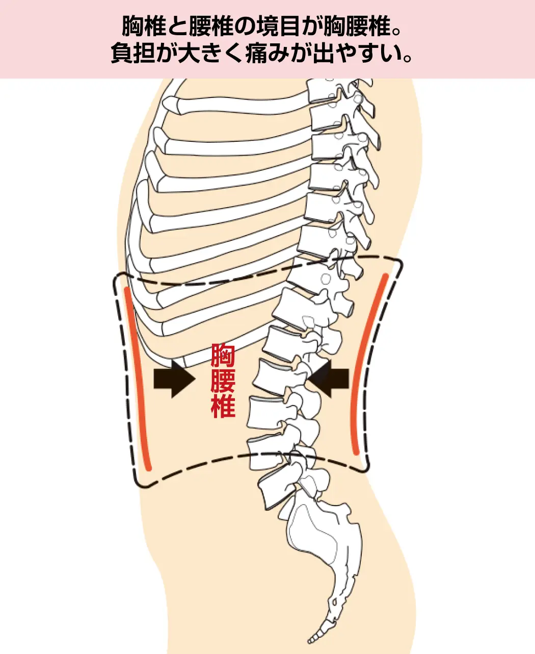 医療用 メッシュ生地コルセット 圧迫骨折 胸椎骨折 腰痛 ヘルニア
