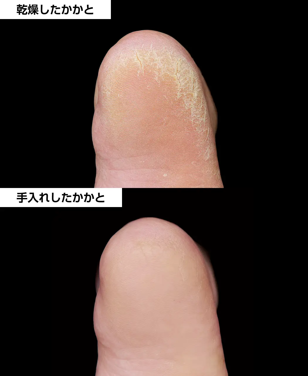 ちりめんシルク肌磨きパフ3