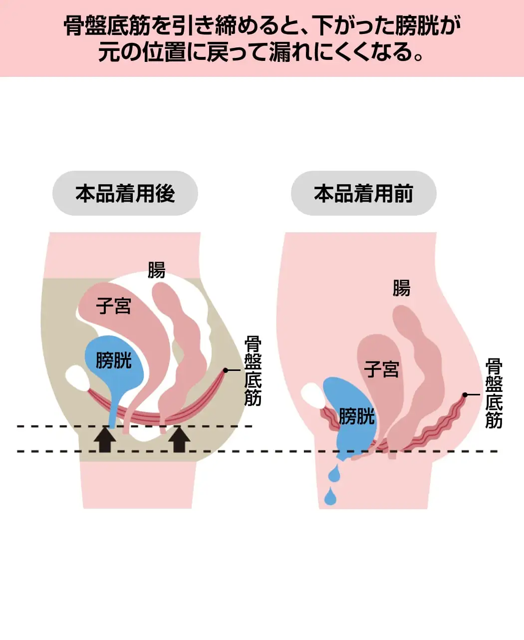 整体ショーツ 凛メディ・コットンタイプ2