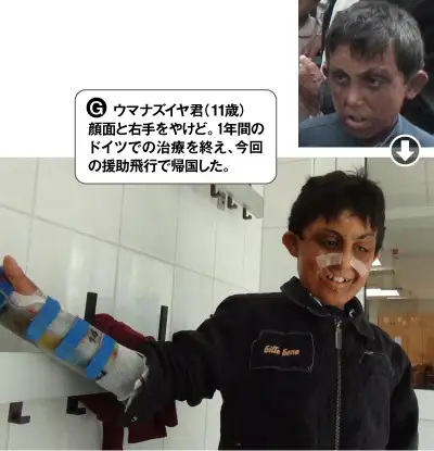 G・ウマナズイヤ君(11歳)。顔面と右手をやけど。1年間のドイツでの治療を終え、今回の援助飛行で帰国した。